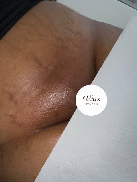 Het verschil spreekt voor zich ! Een Brazilian wax zorgt voor een glad resultaat, een frisse uitstraling en wekenlang...