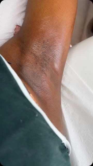 First time waxing 🫶🏼 Nog aan het twijfelen? De resultaten spreken voor zich 😊 Wacht vooral niet en start je wax jo...